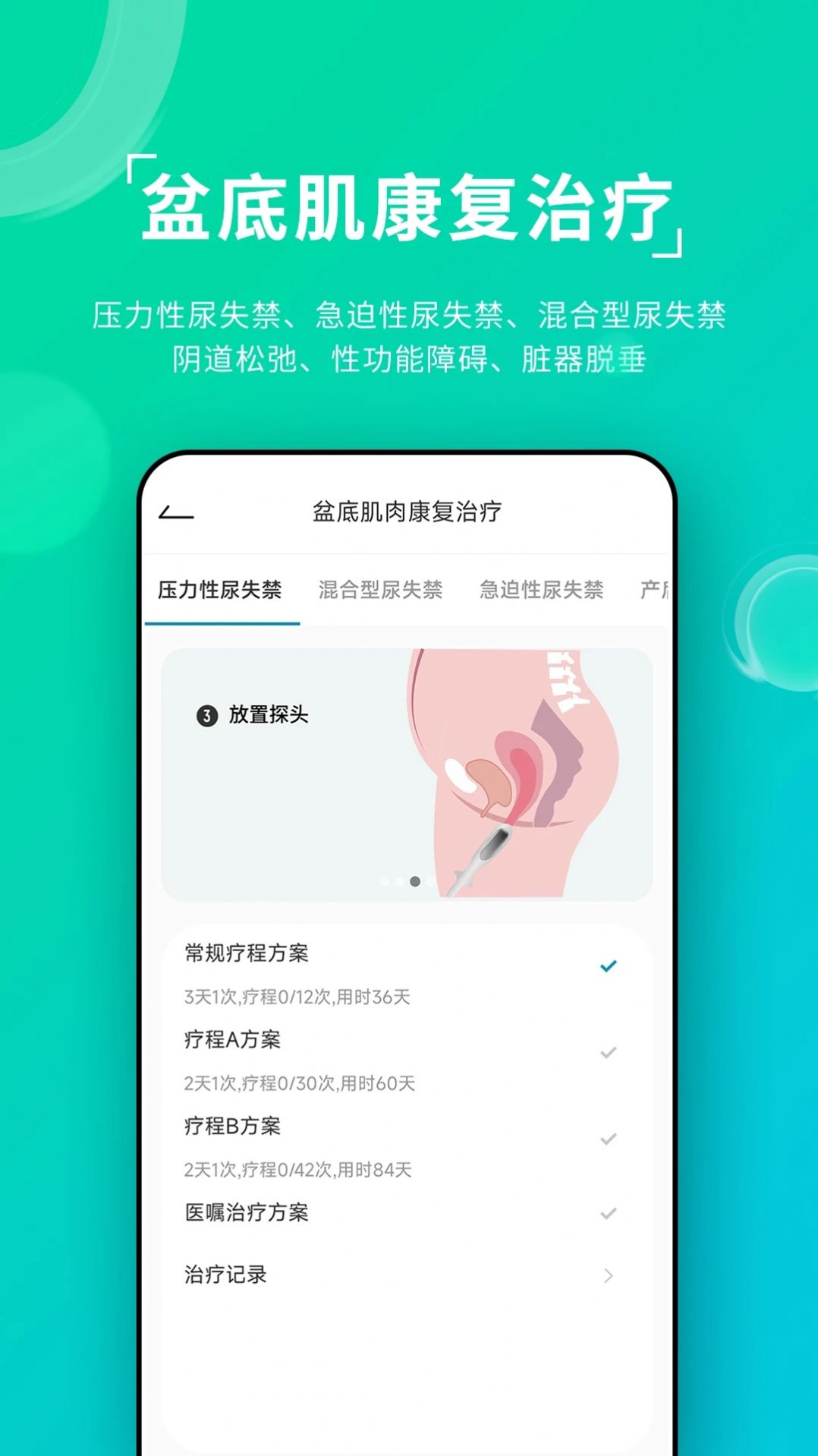 云天开盆底软件手机版下载 v1.0.0