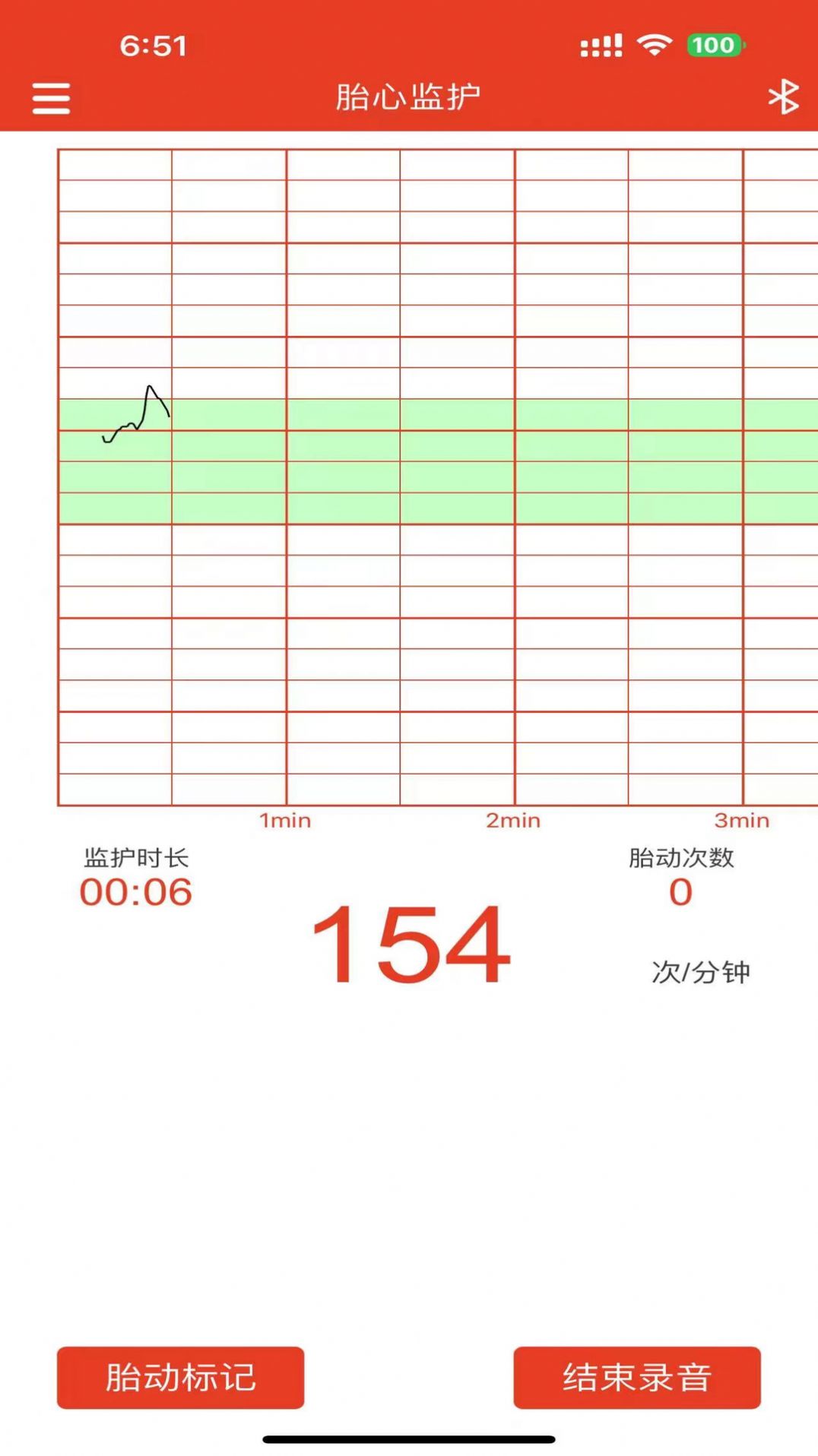 左点胎心仪app手机版下载 v1.0